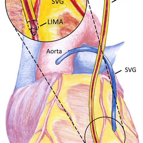 Left Internal Mammary Artery Anatomy