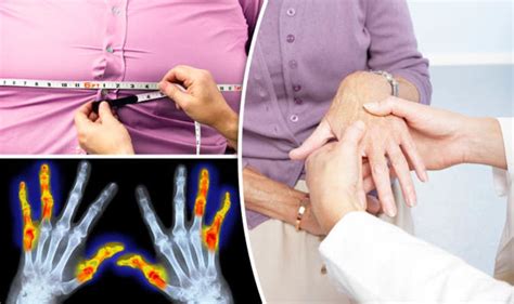 Rheumatoid Arthritis Overweight And Obese People At Greater Risk Uk
