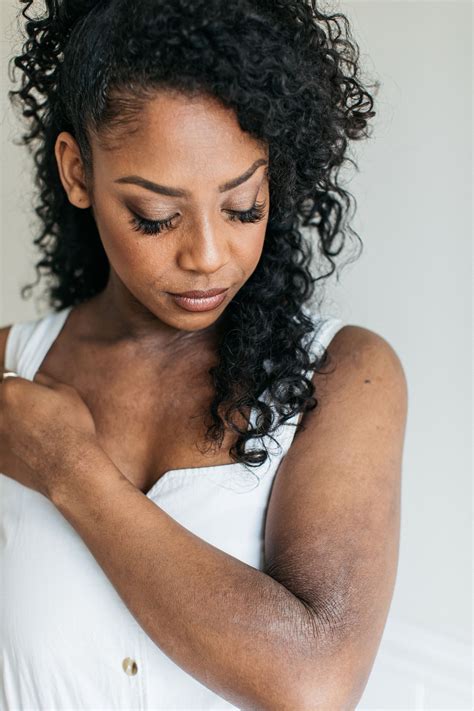 How To Treat Eczema On The Face According To Dermatologists