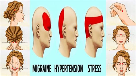 This element helps greatly in controlling of high blood pressure. Migraine pressure points | Throbbing headache, Pressure ...