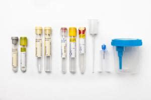 Bd Vacutainer Urine Collection Devices And Kits Bd Biosciences Ward