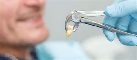Check spelling or type a new query. Tooth Extraction Aftercare: Do's and Don'ts - Clove Dental