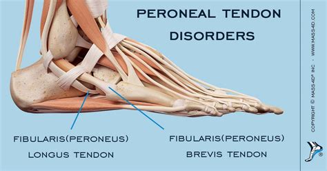 What Are Peroneal Tendon Disorders Mass4d® Insoles And Foot Orthotics