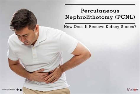 Percutaneous Nephrolithotomy Pcnl How Does It Remove Kidney Stones