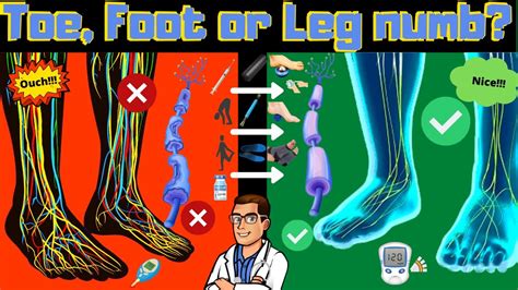 Numbness In Toes Feet Or Legs Causes And Numb Foot Treatment Youtube