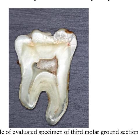 Figure From Reliability Comparison Of Two Forensic Dental Age