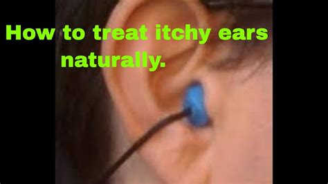 How To Treat Itchy Ears Naturally Youtube