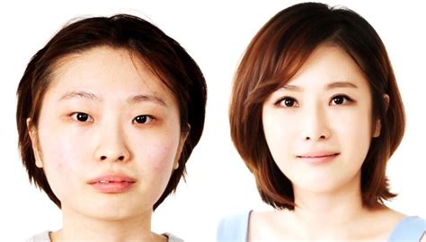 Koreas Plastic Surgery Culture