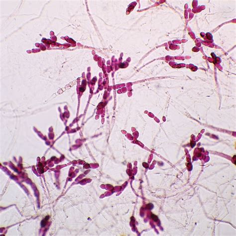 Vs Of Gametophyte Under Microscope Micropedia