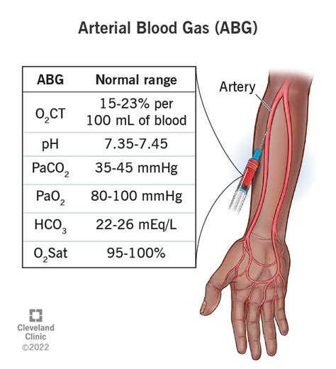 Arterial Blood Gas ABG What It Is Purpose Procedure Levels Blood Gases
