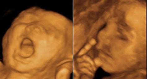 Amazing 4d Ultrasound Scans Show Unborn Babies Yawning And Picking