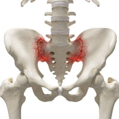 Sakit punggung sebelah kanan atas bisa disebabkan oleh banyak hal. Sakit Belakang & Slip Disc: Punca, Simptom dan Rawatan ...