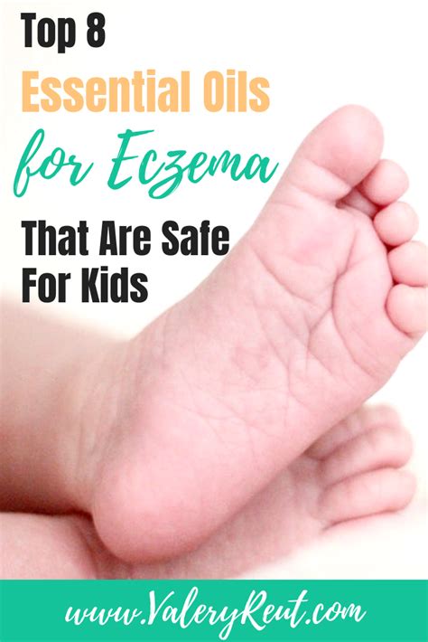 Top 8 Essential Oils For Eczema That Are Safe For Kids Oils For