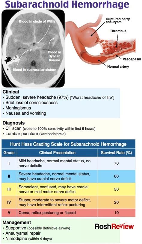 Subarachnoid Hemorrhage Emergency Medicine Medical Knowledge