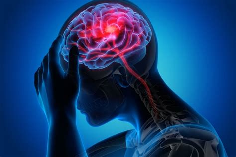 Neurological Disorders Symptoms Diagnosis And Causes