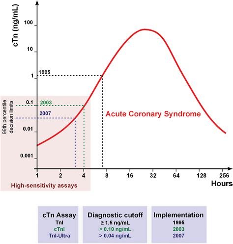 Figure From How To Interpret Elevated Cardiac Troponin Levels