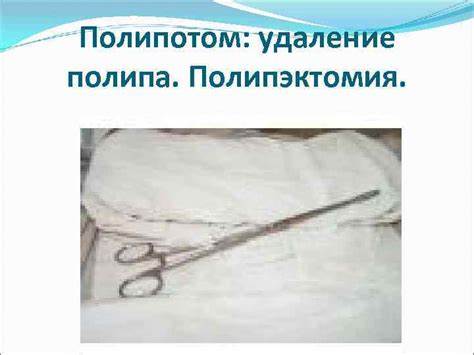 После диеты полипэктомия