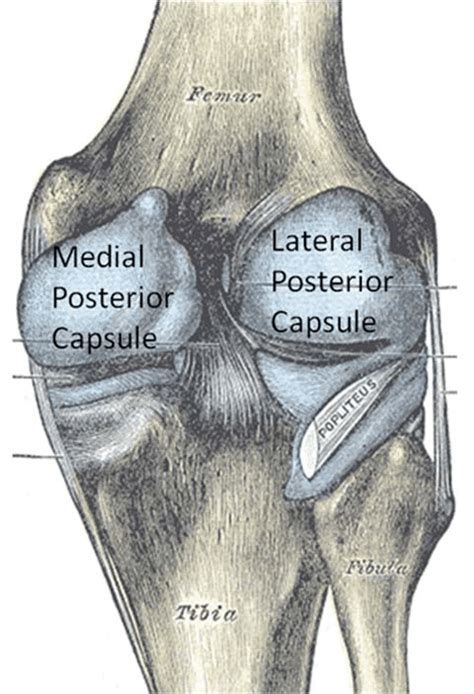 Posterior View Of The Knee With Posterior Capsules Shown In Blue