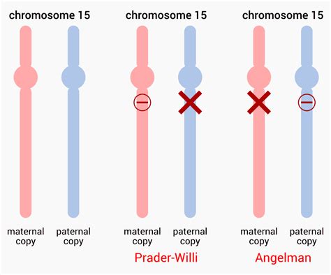 What Is Prader Willi Syndrome