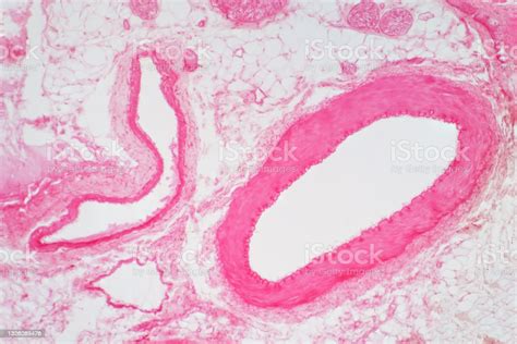 Artery Vascular Cross Section Under The Light Microscope View For Pathology Education Stock
