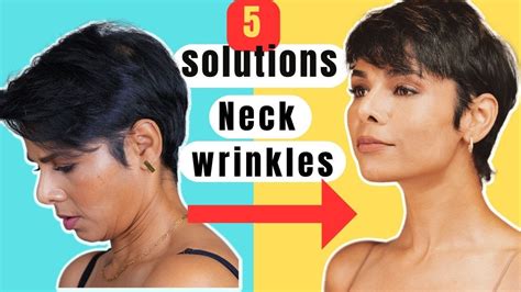 How To Reduce Neck Wrinkles Naturally5 Solutions Youtube