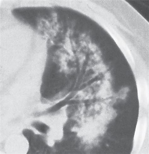 16 Lungs Radiology Key