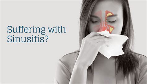Sinusitis Causes And Symptoms Alamo Ent Associates