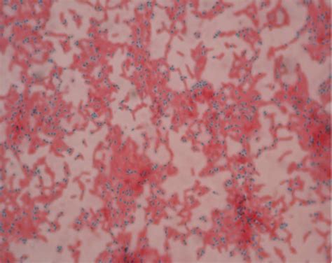 Endospore Stain Red Mountain Microbiology