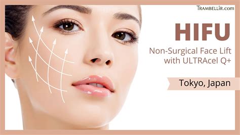 Hifu Non Surgical Face Lift With Ultracel Q Trambellir