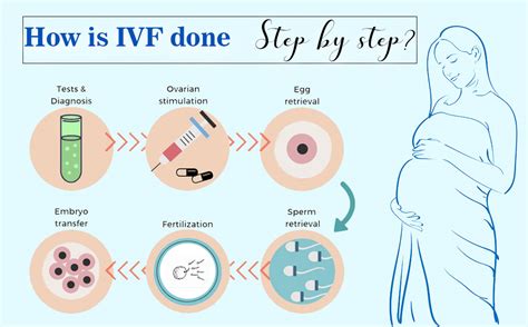 Ivf Treatment Procedure Step By Step Knowivf Steps Included In Ivf