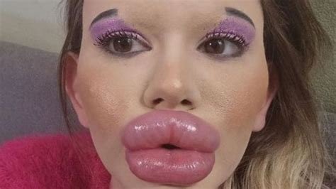 Journey Of Andrea Ivanova With Worlds Biggest Lips Quest For Extreme Physical Appearance