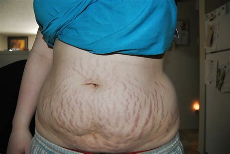BBW S With Cellulites And Stretch Marks Photo X Vid