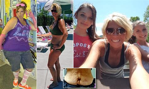 obese mother lora jones wears a bikini for the first time after losing 168lbs