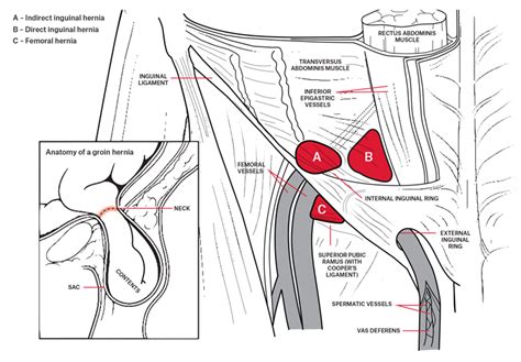 Diagram Of Groin Muscles