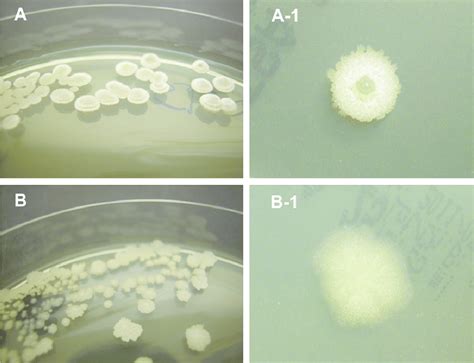 Colony Morphology Of Bacteria Isolated Strain E Bacillus Subtilis