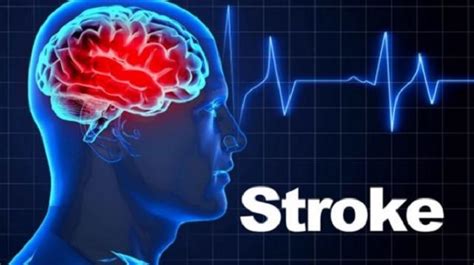 Why Strokes Mostly Occur In Bathrooms Doctor Explains Jk News Live
