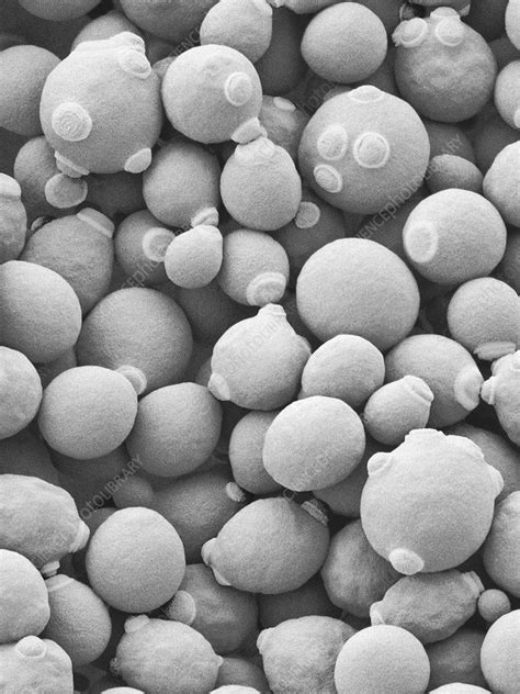 Candida Albicans Yeast Stage Sem Stock Image C0370270 Science