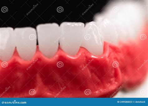Lower Human Jaw With Teeth And Gums Anatomy Model Isolated On Blue