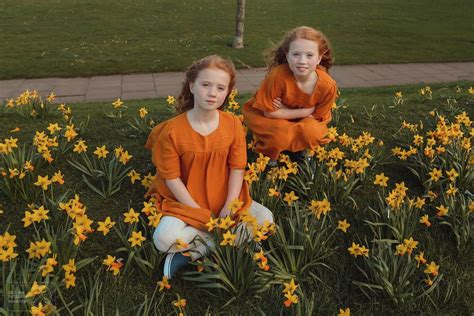 10 Pictures Of Ginger Twins I Took In Scotland Artofit