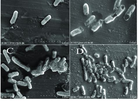 Electron Microscope Bacteria Images Micropedia