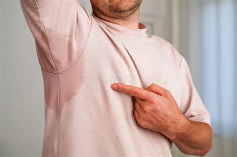 Man With Hyperhidrosis Sweating Very Badly Under Armpit Stock Image