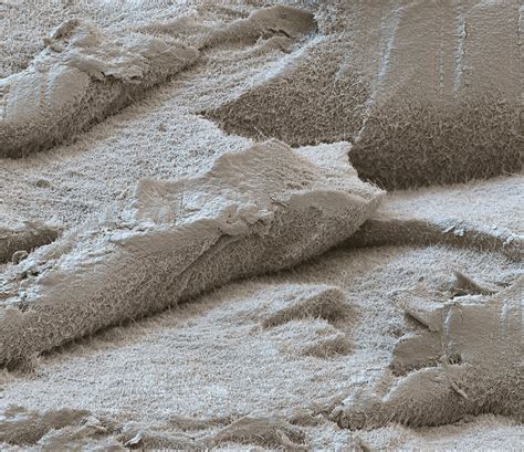 Cartilage Sem Stock Image C Science Photo Library