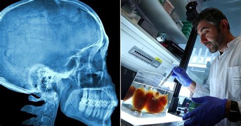 Scientists Have Discovered New Organs In The Human Skull And We Dont