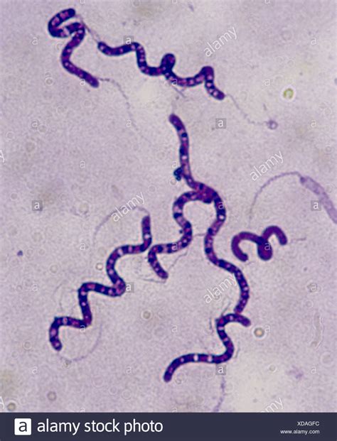 Bacteria Under Microscope 1000x Micropedia