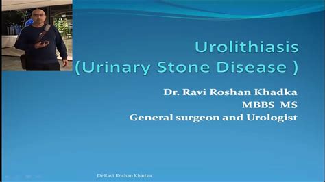 Introduction To Urinary Stone Disease Urolithiasis Youtube