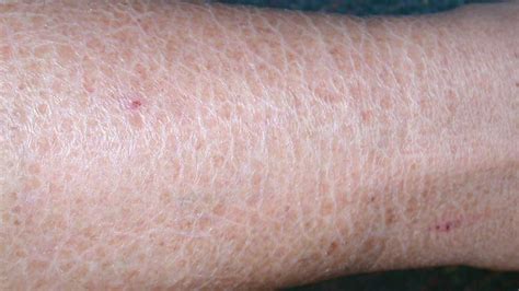 Itching Pictures Causes Diagnosis And Home Remedies