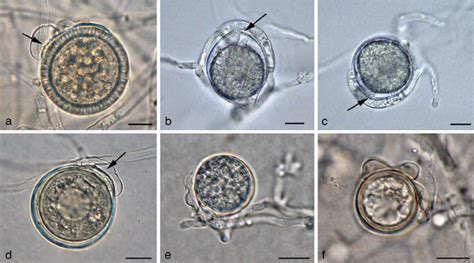 Oogonia And Antheridia Of Phytopythium Species A P Sindhum