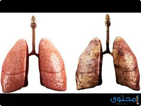 طريقة تنظيف الرئة من التدخين موقع محتوى