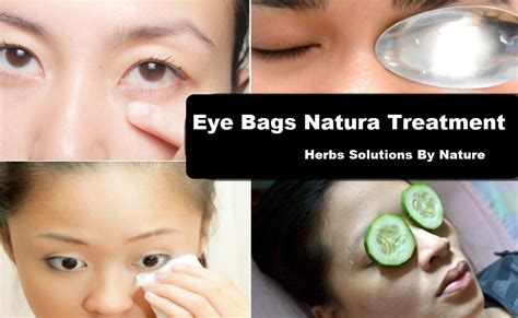 Eye Bags Herbs Solutions By Nature