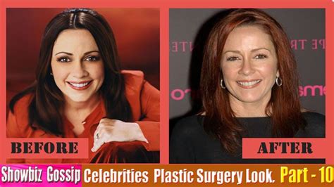 101 Celebrities Plastic Surgery Before And After Look 91 101 Part